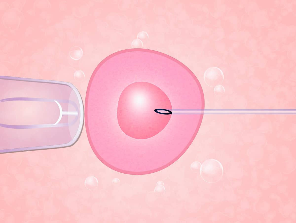 Insemina O Intra Uterina Ou Fertiliza O In Vitro Vida Centro De