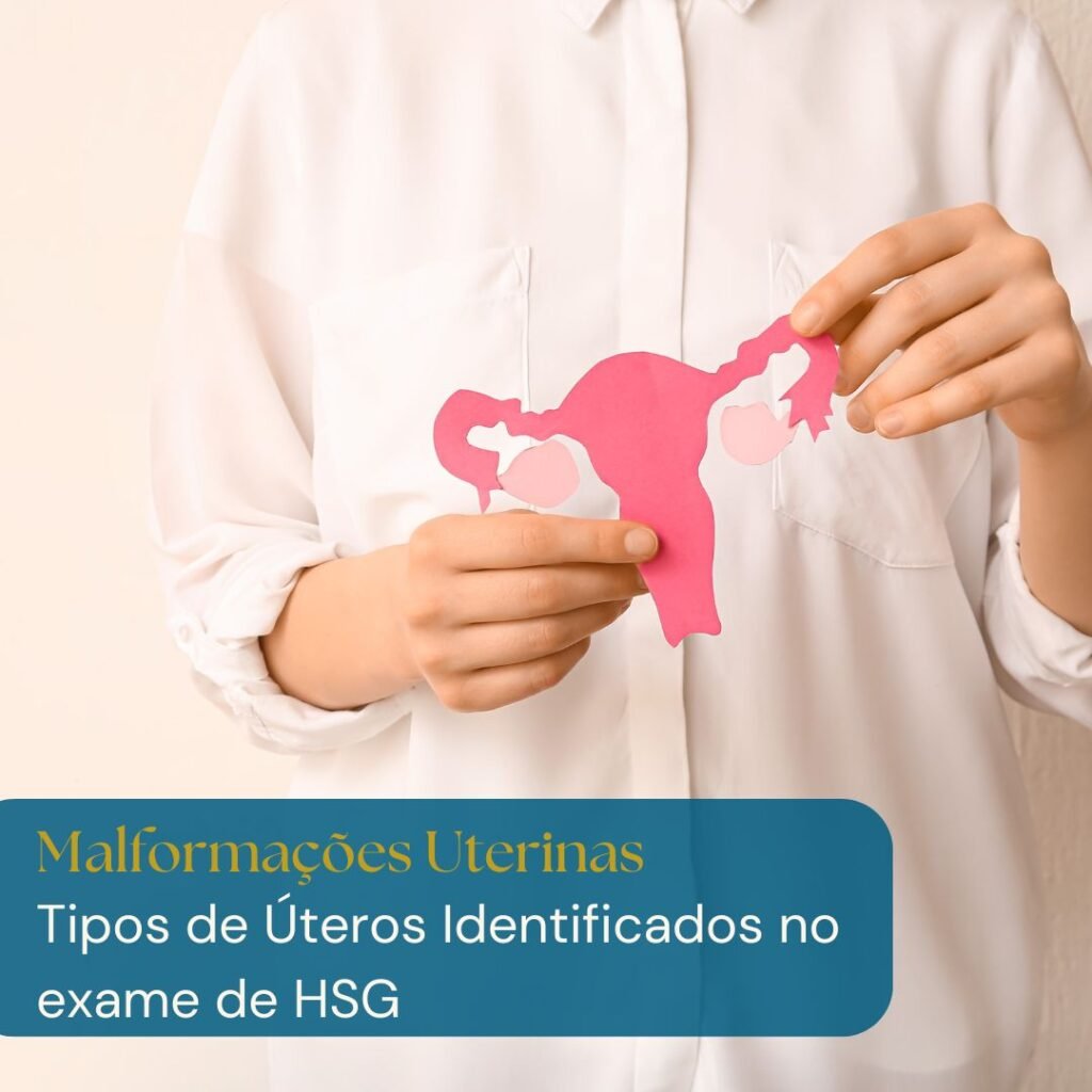 malformações uterinas